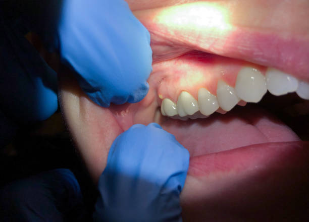 Best Broken Tooth Emergency  in Oskaloosa, IA